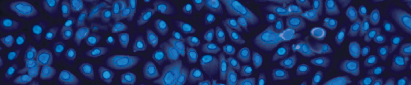 Blue lung epithelial cystic fibrosis cells.