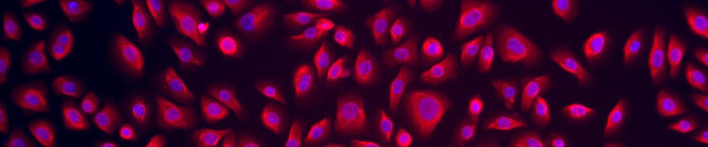 Red and blue lung epithelial small airway cells.