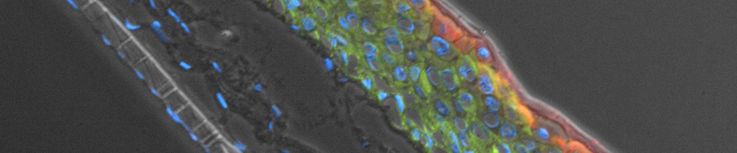 Ker-ct filiggrin epithelial cells.