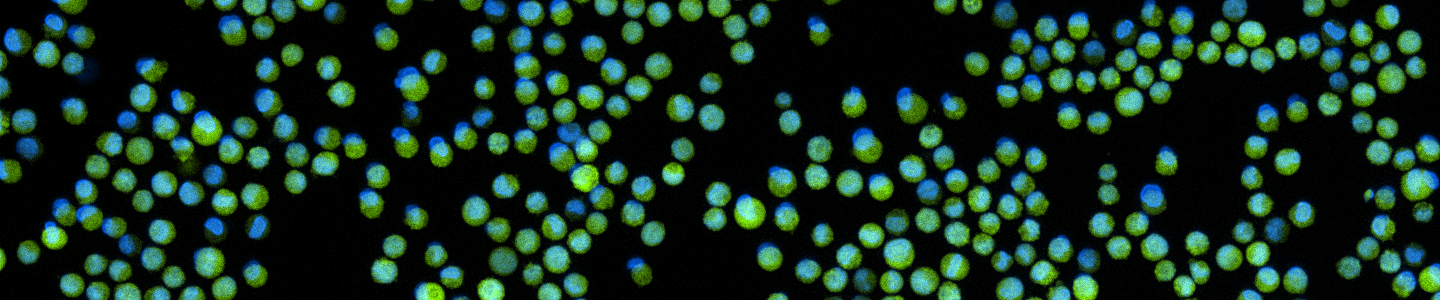 Green K562-GFP with nuclear stain.