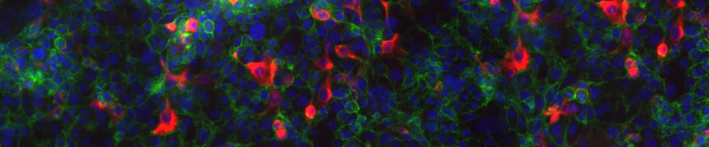 Fluorescent blue, red, and green colon cells.