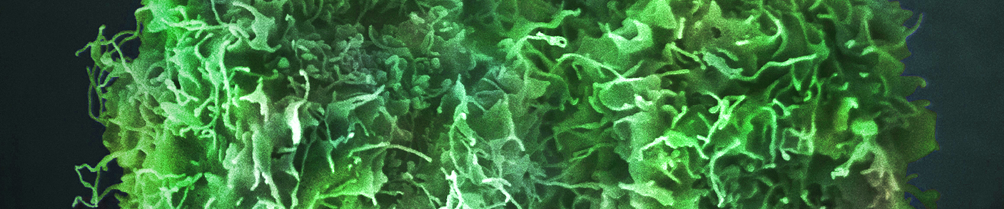 Green skin cancer cells.