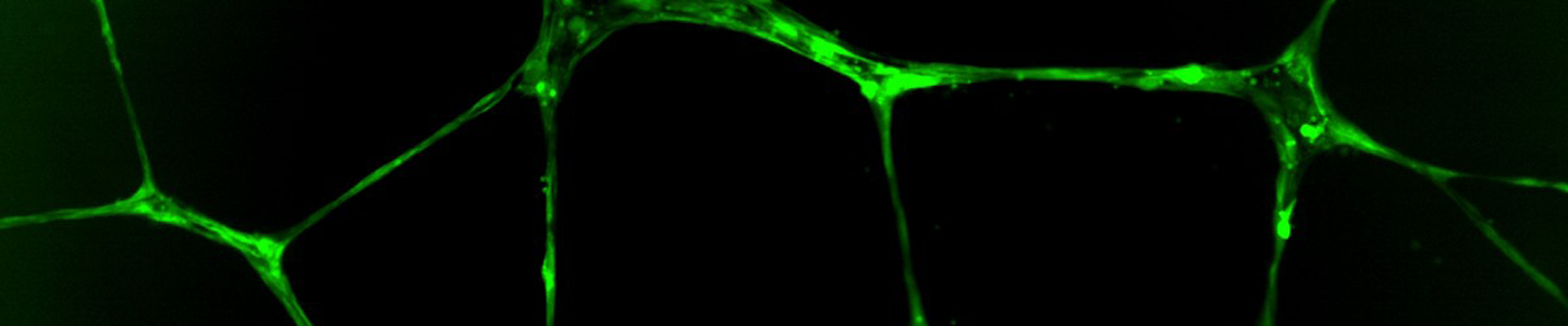 Green tubulogenesis microvascular endothelial cell.