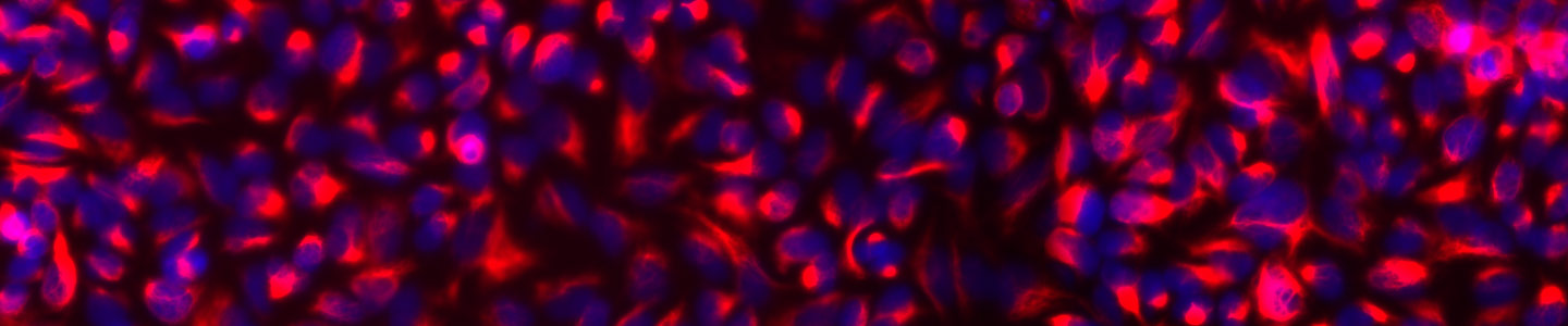 Fluorescent red and blue, red, and black colon cells.