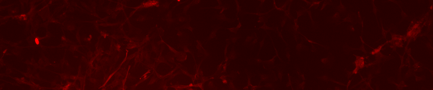 Red lung MCB cells.