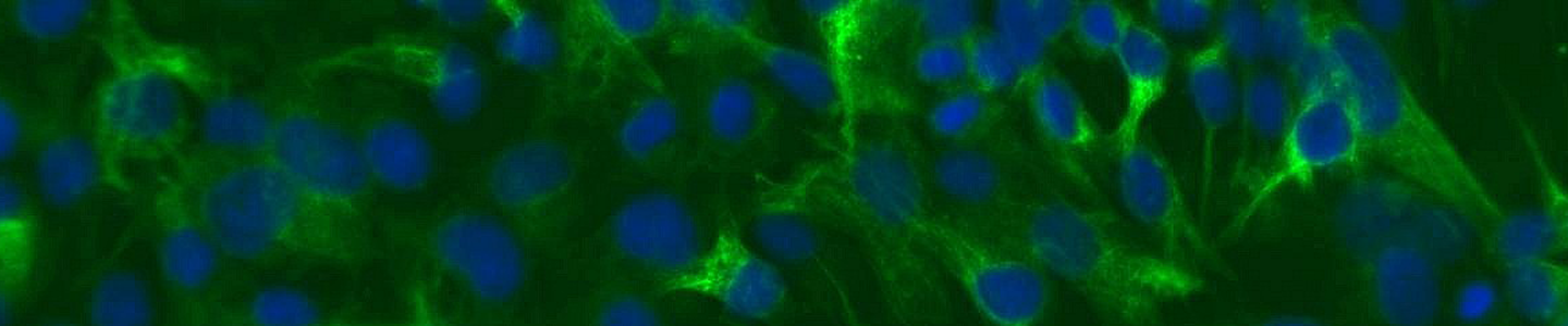 Green and blue kidney epithelial melanocyte cells.