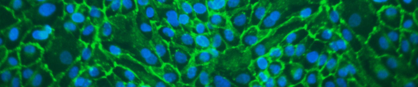 Fluorescent lime green and blue web of  renal proximal tubular epithelial cells.