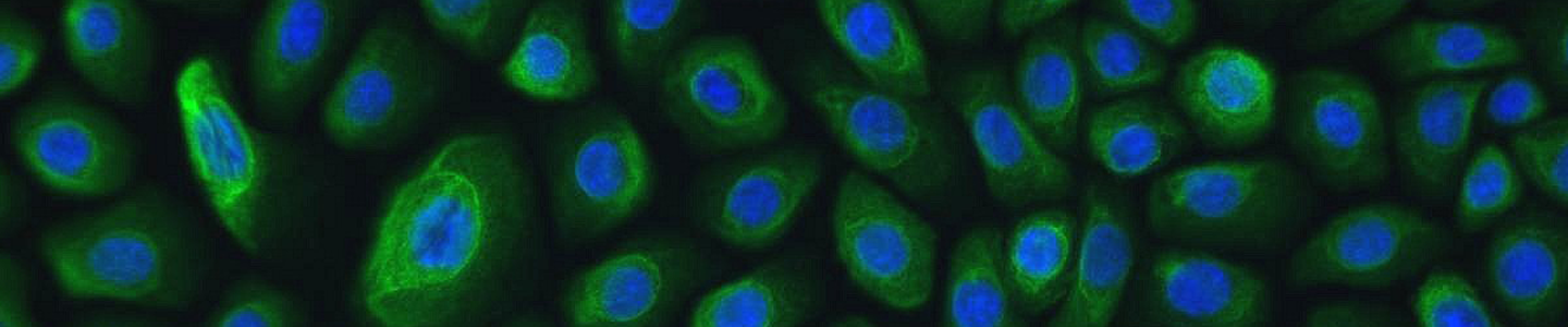 Green and blue normal bronchial lung epithelial cells.