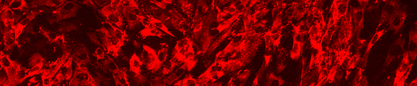 Red hTERT prostate cells.