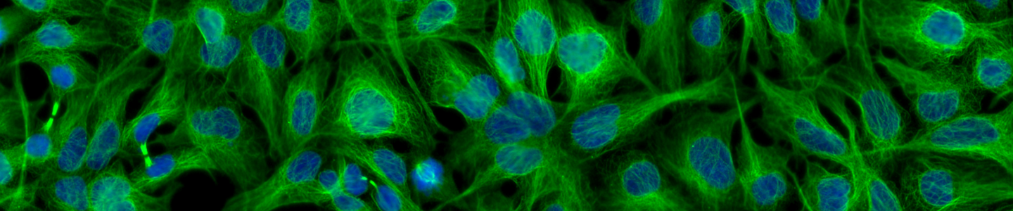 Blue and green beta tubulin antibody cells.