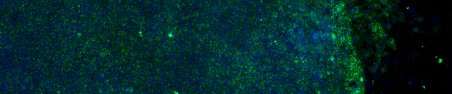 Blue and green embryonic induced pluripotent stem cells.