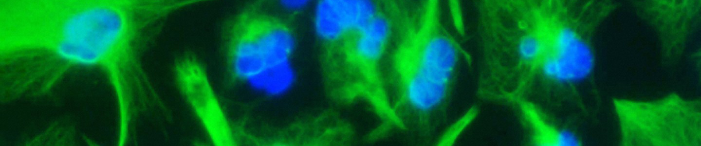 Green and blue brain cancer stem cells
