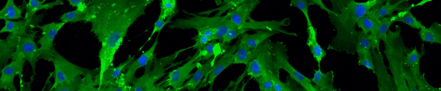 Green and blue mesenchymal IPS stem cells.