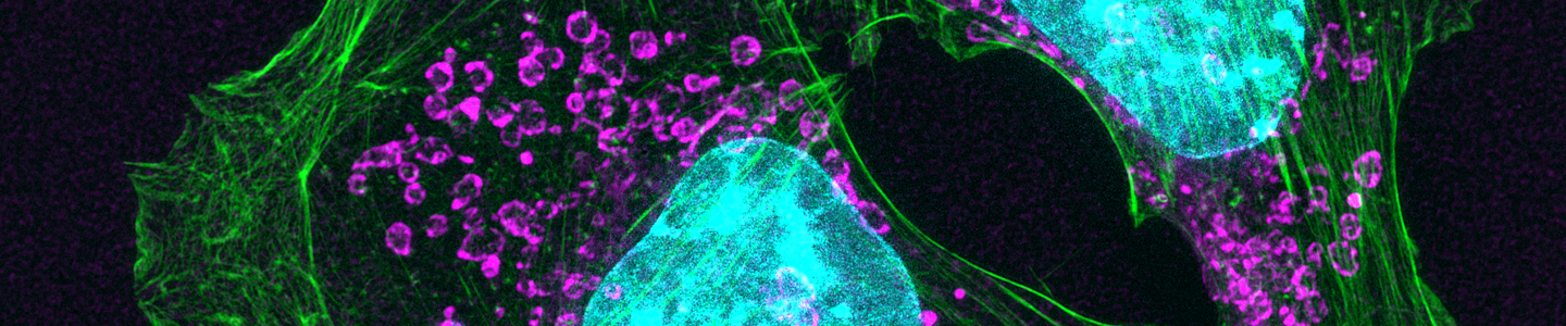 Purple and green top mouse skin cancer cells.