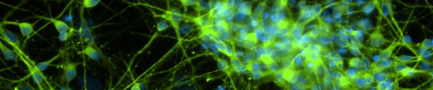 Green and blue dopaminergic Diff MAP2 DAPI cells.
