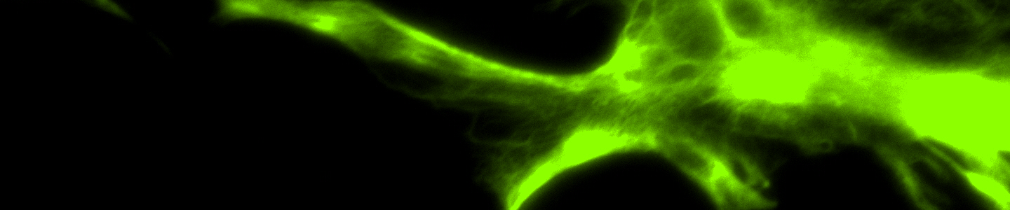 Green astrocyte GFAP neural progenitor cells.