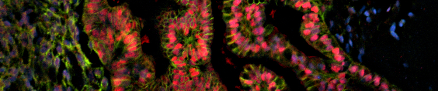 Blue, pink and green IPS organoid cells.