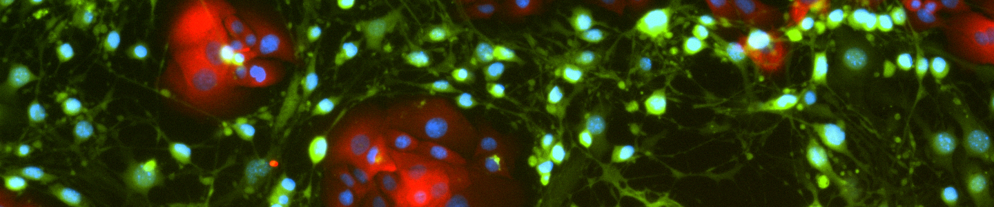 Green and red conditionally reprogrammed organoid cells.