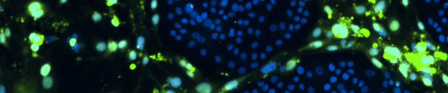 Green and blue conditionally reprogrammed organoid cells.