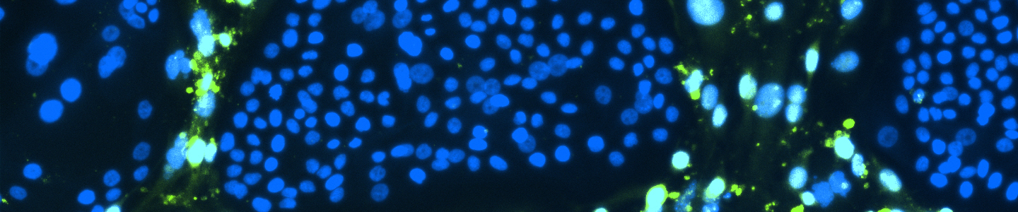 Green and blue conditionally reprogrammed organoid cells.