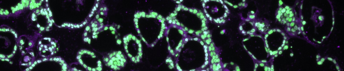 Green and purple ICC organoid cells.