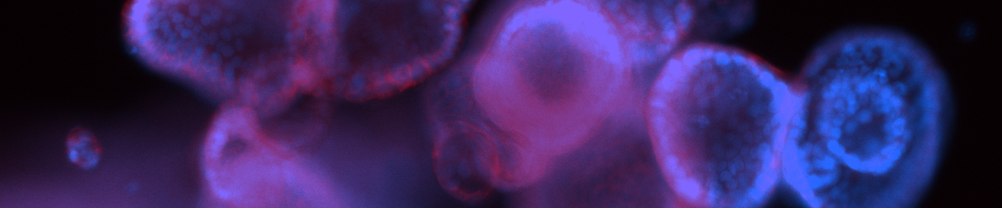 Blue and purple ecad488 organoid cell models.