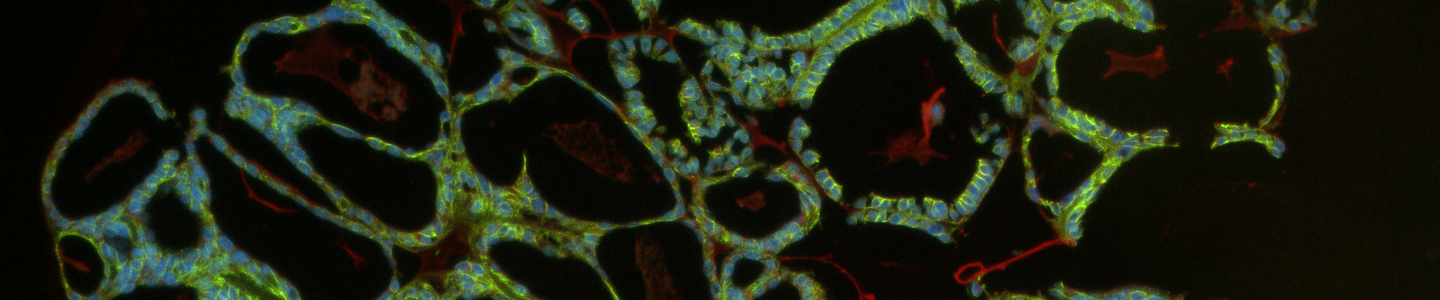 Green and red organoid cells.