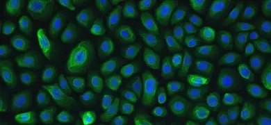 Green and blue NuLi lung epithelial small airway cells.