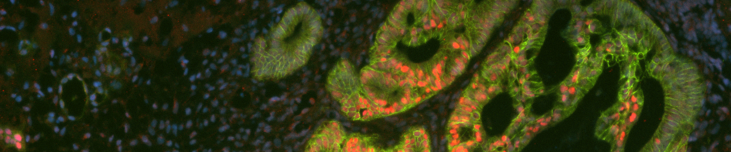 Green, blue and red organoid cells.