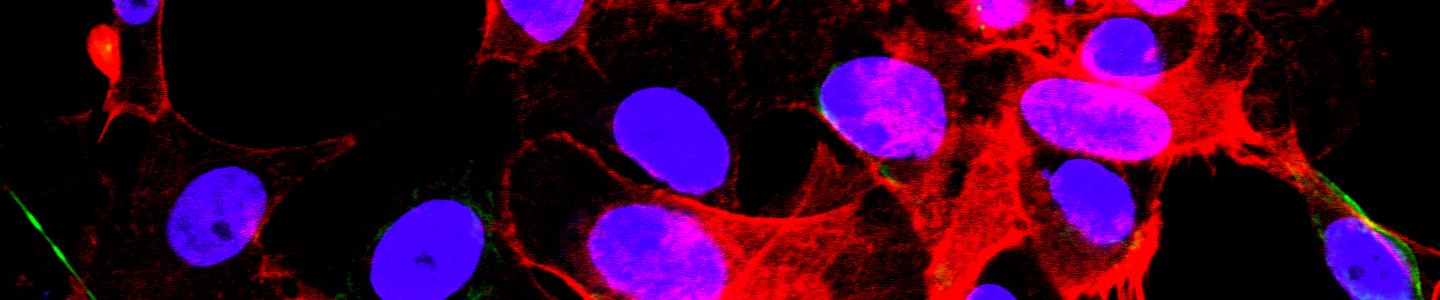 Purple and red HTB-9 B-Catenin monolayer cells.