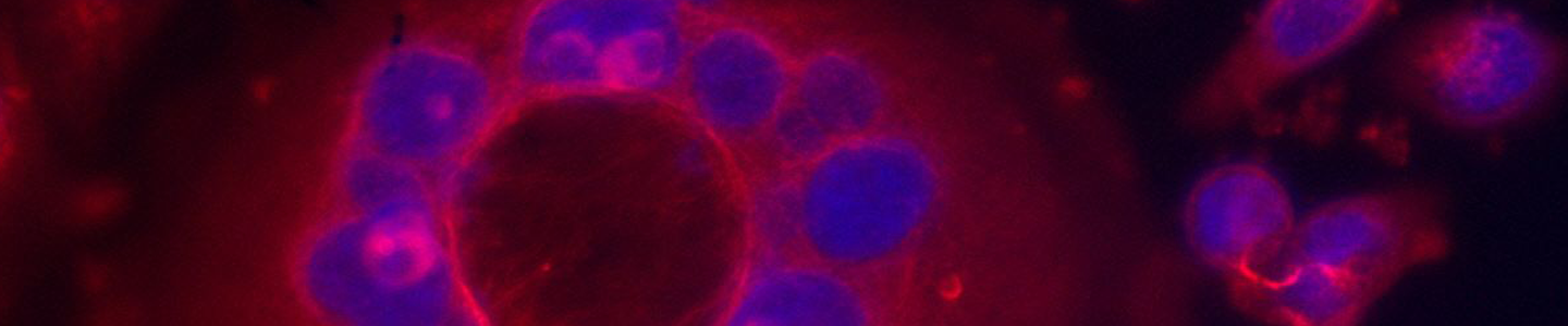 Blue and red mcf-7 human breast cells.
