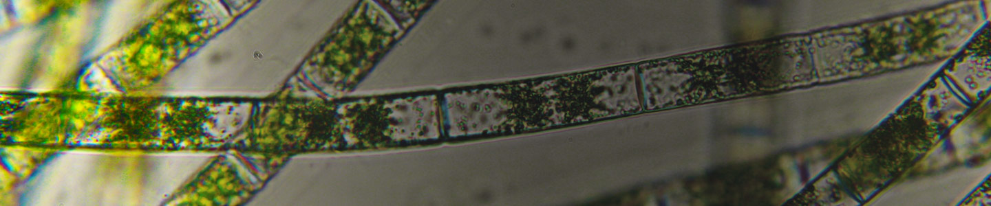 Green zygnema algae.