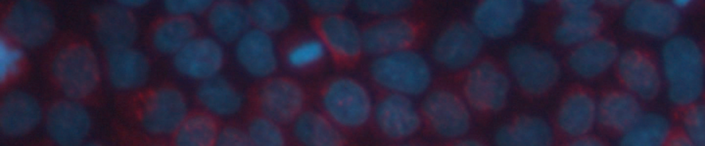 Blue and red donor upcyte hepatocytes.