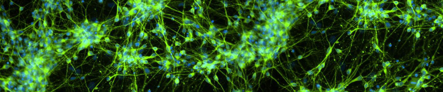Fluorescent green and blue neurons.
