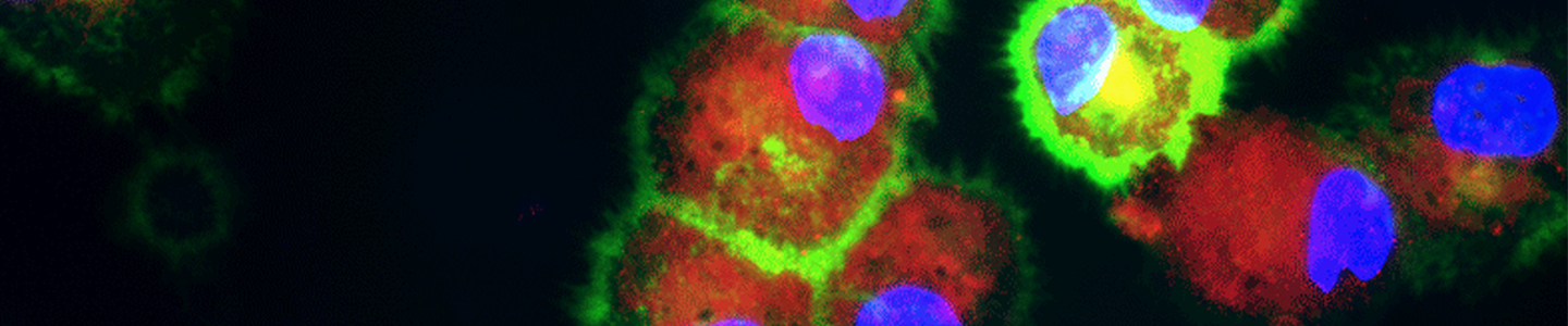 Fluorescent red, lime green, purple, and blue dendritic cells.