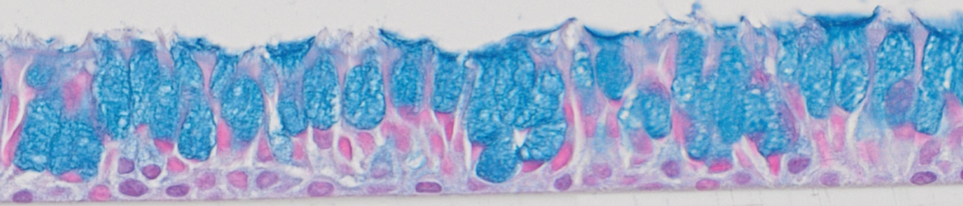 alcian blue stain airway histology primary bronchial cells