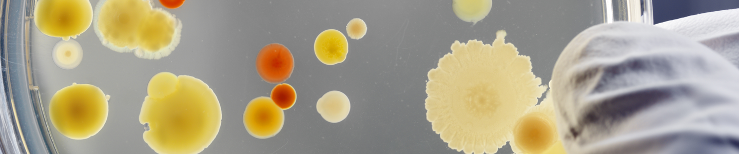 Gloved fingers holding one side of a petri dish containing orange, cream, and yellow spheres of bacteria.