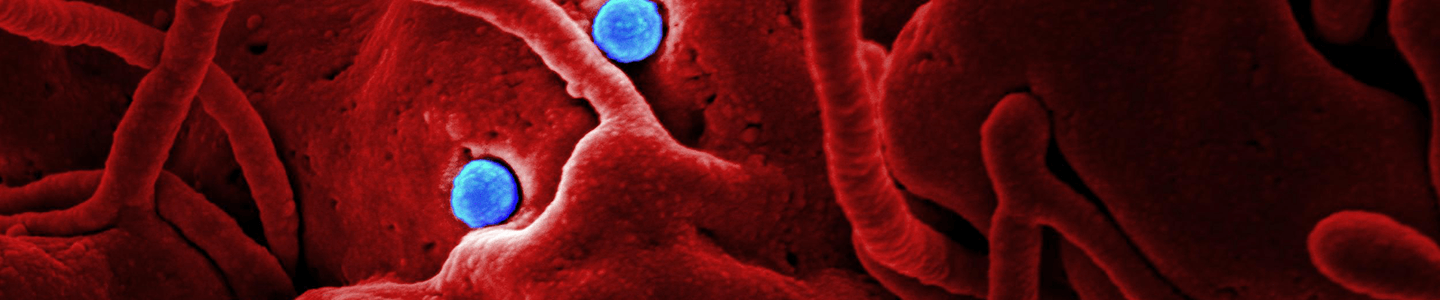 Bright blue balls lodge in a red, porous Middle East Respiratory syndrome coronavirus cluster.