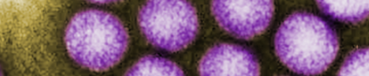 Purple and white spheres of adenovirus.