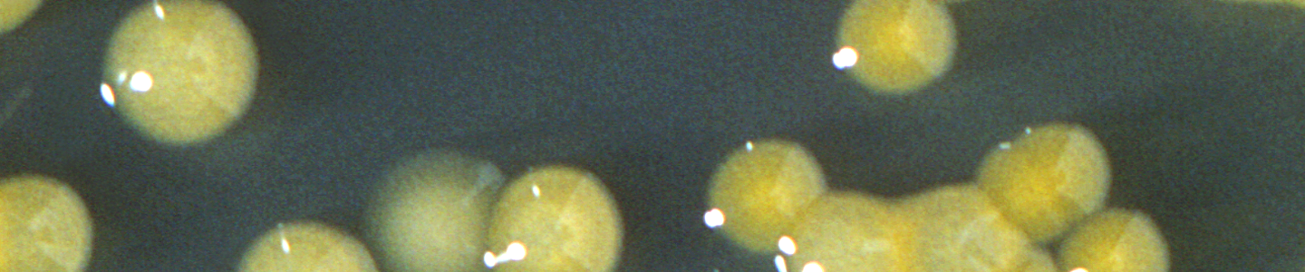 Yolk-like spheres of Enterobacter sakazakii bacteria.