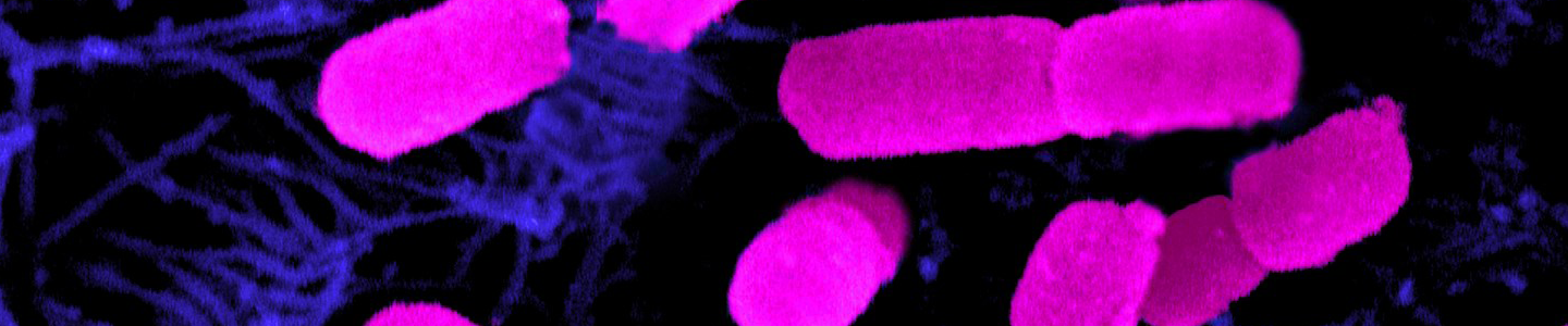 Fluorescent pink, rod-shaped Escherichia coli bacteria.