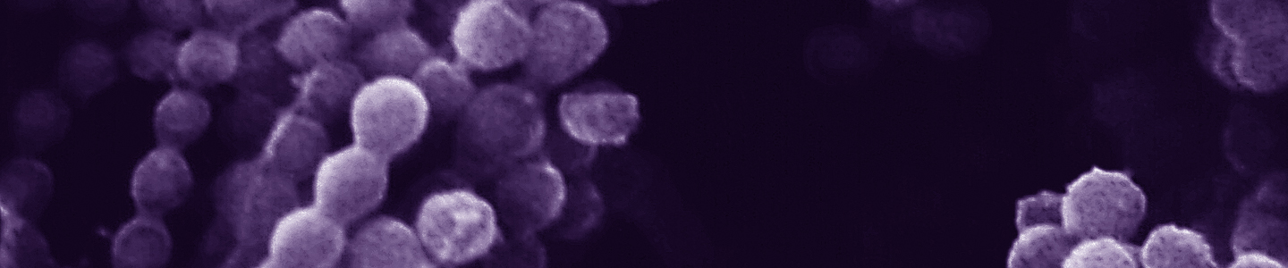 Purple strands of grape-like Aspergillosis fungus.