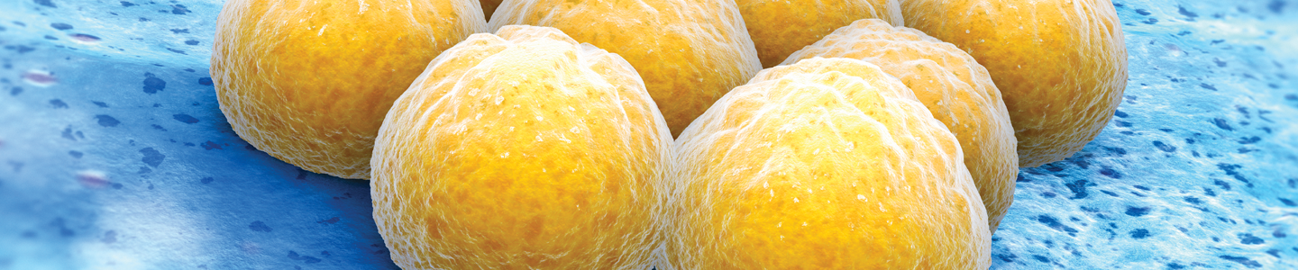 Yellow balls of Staphylococcus, aureus bacteria.