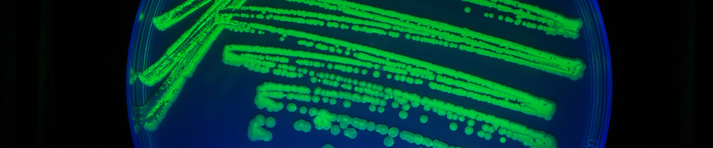 Petri dish filled with bright-blue and green media and cells in a line and spot pattern.