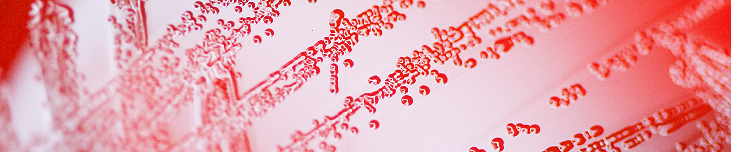 Closeup of blood agar in a petri dish.