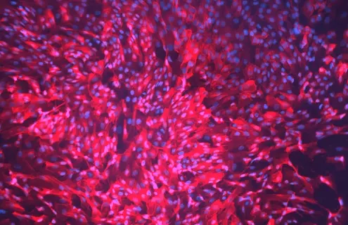 Blue and pink hTERT renal proximal tubular epithelial cells.