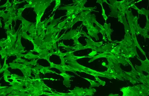 Green mesenchymal IPS stem cells.