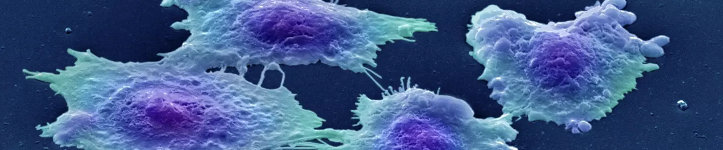 Human colon cancer cells.