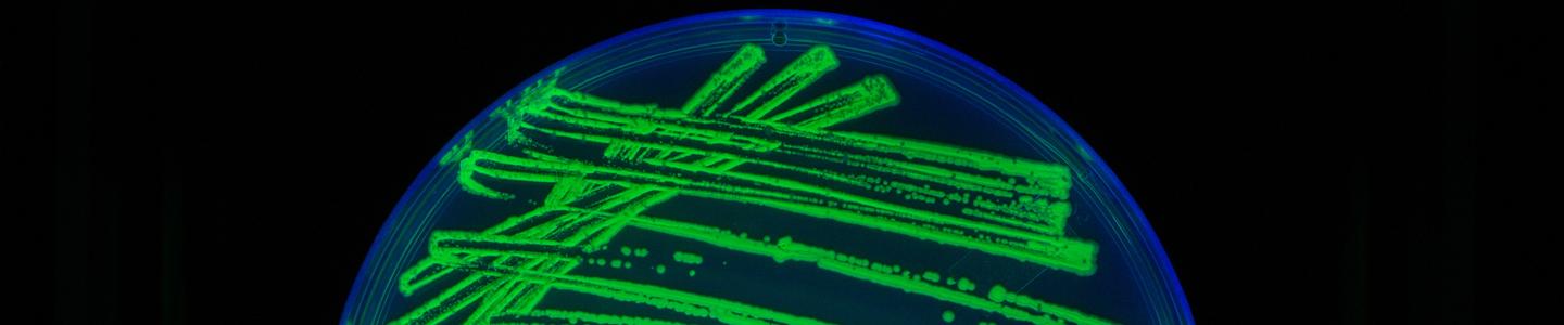 Petri dish filled with bright-blue and green media and cells in a line and spot pattern.