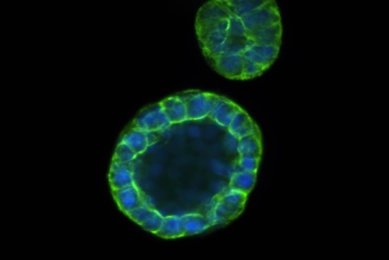 A high-magnification fluorescence microscopy image of two organoids against a black background. The primary organoid is a hollow, spherical structure composed of a single layer of cells with blue-stained nuclei and bright green-stained borders. A smaller, solid-looking organoid with similar staining is visible at the top of the frame.